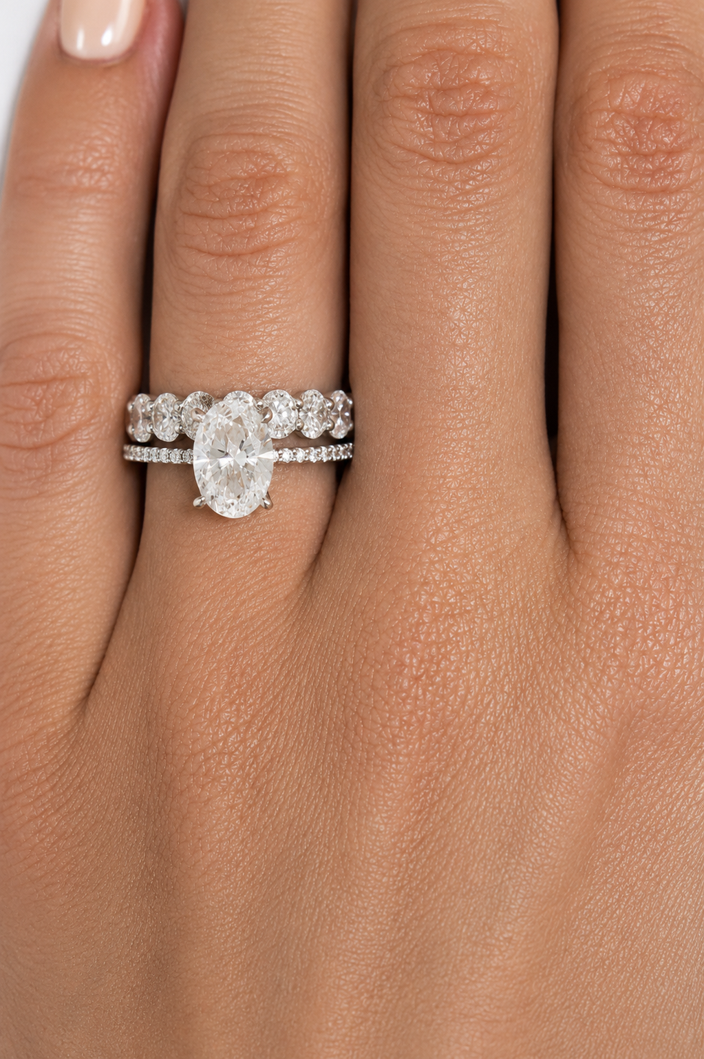 Anillo