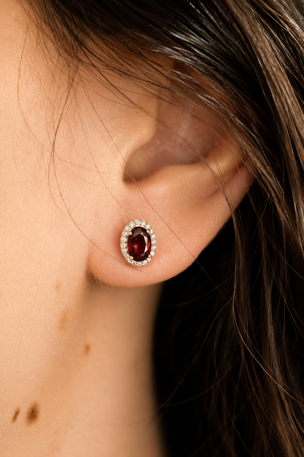 Aretes