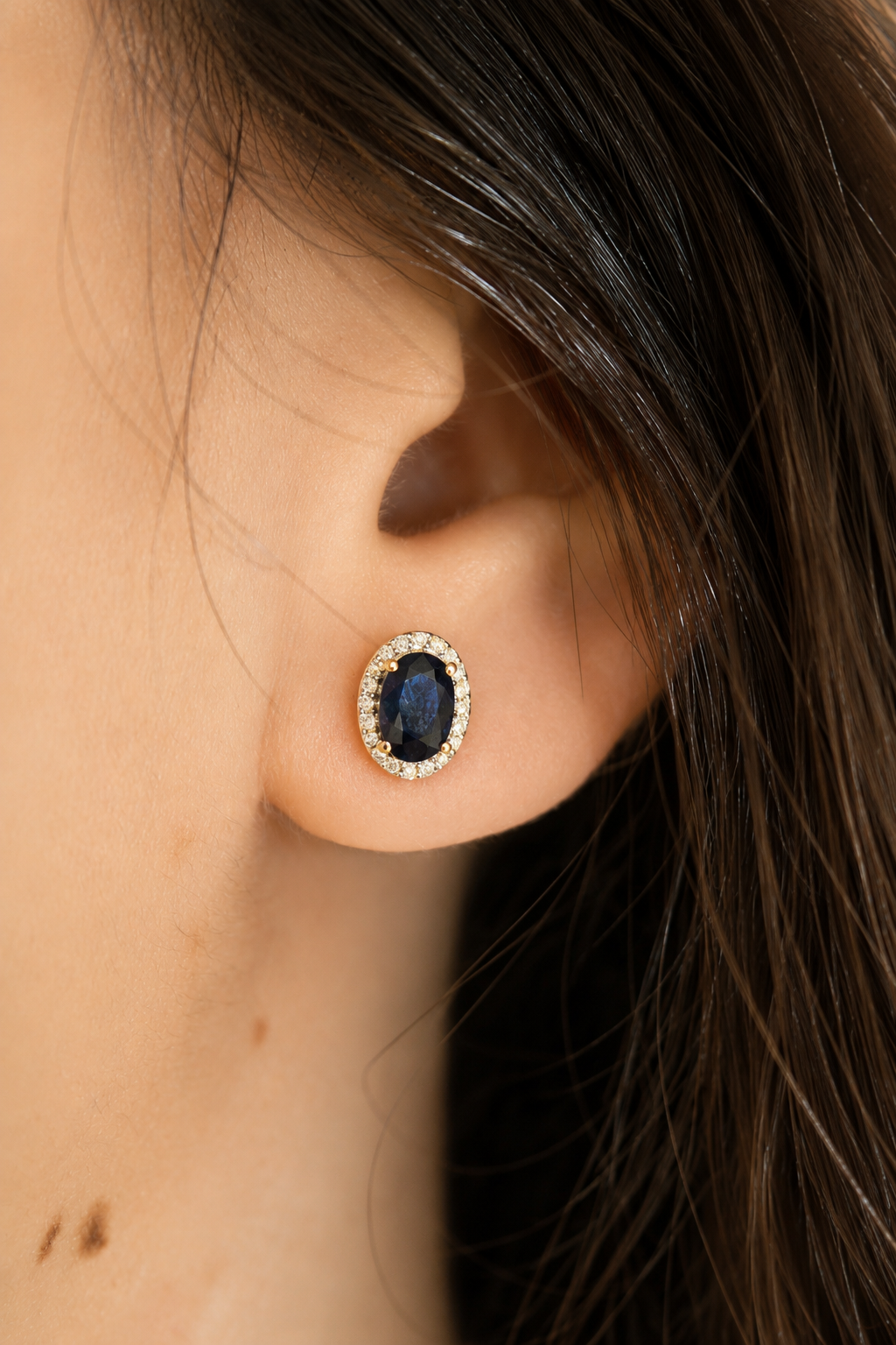 Aretes