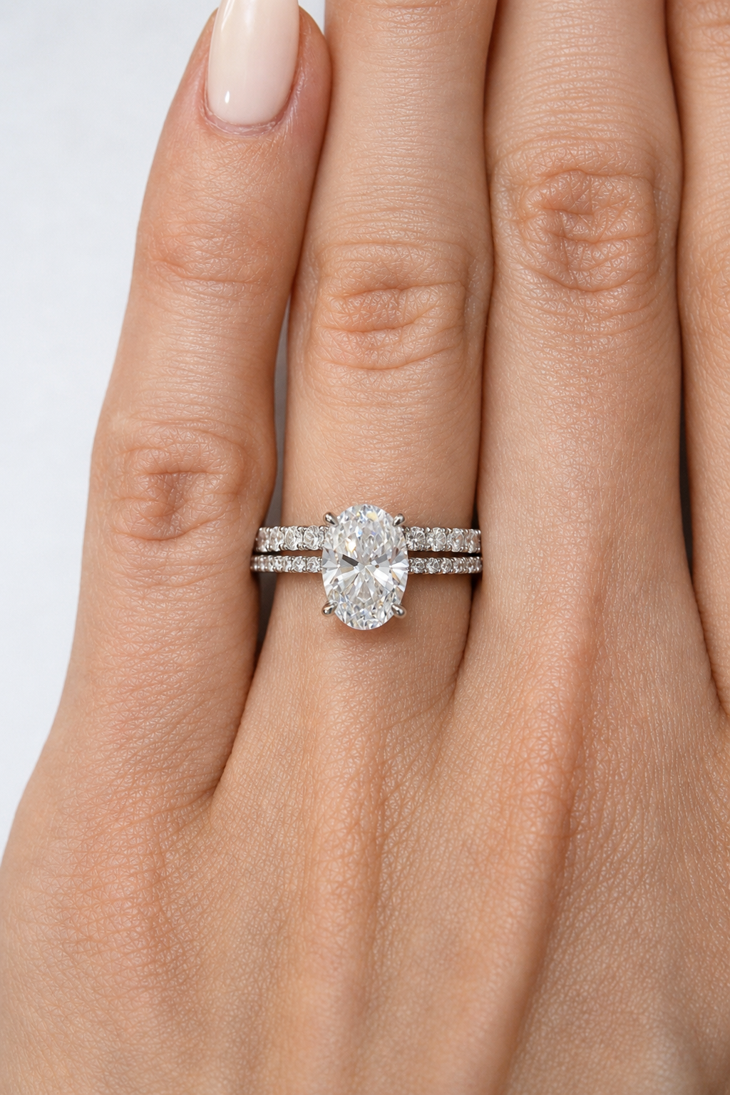 Anillo
