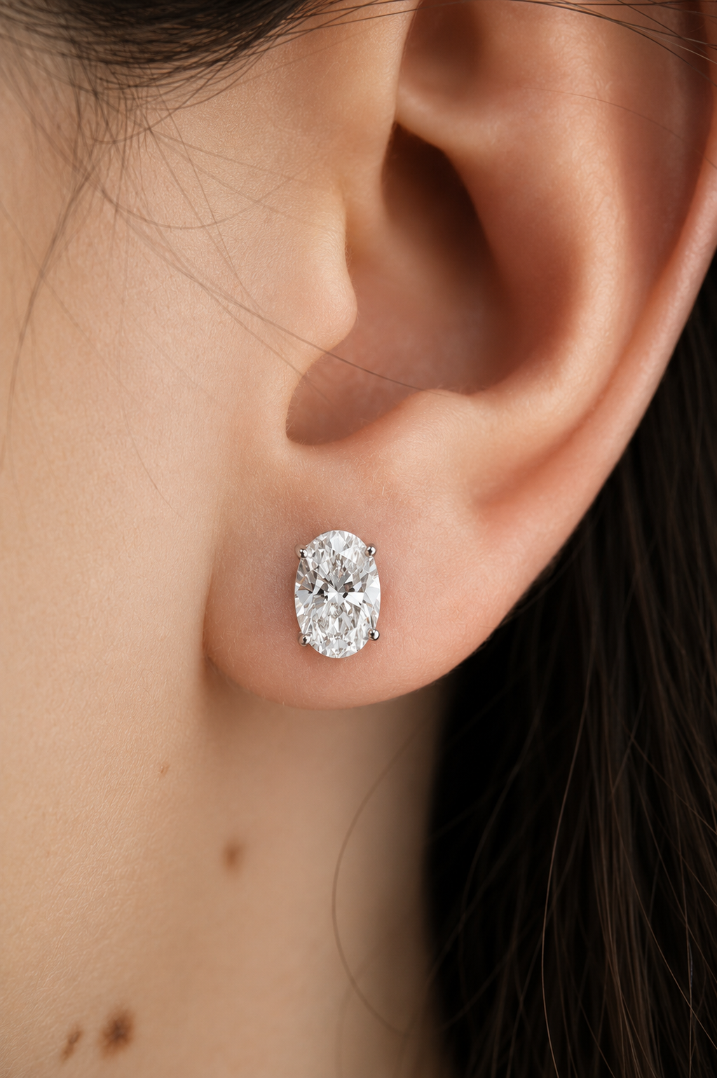Aretes