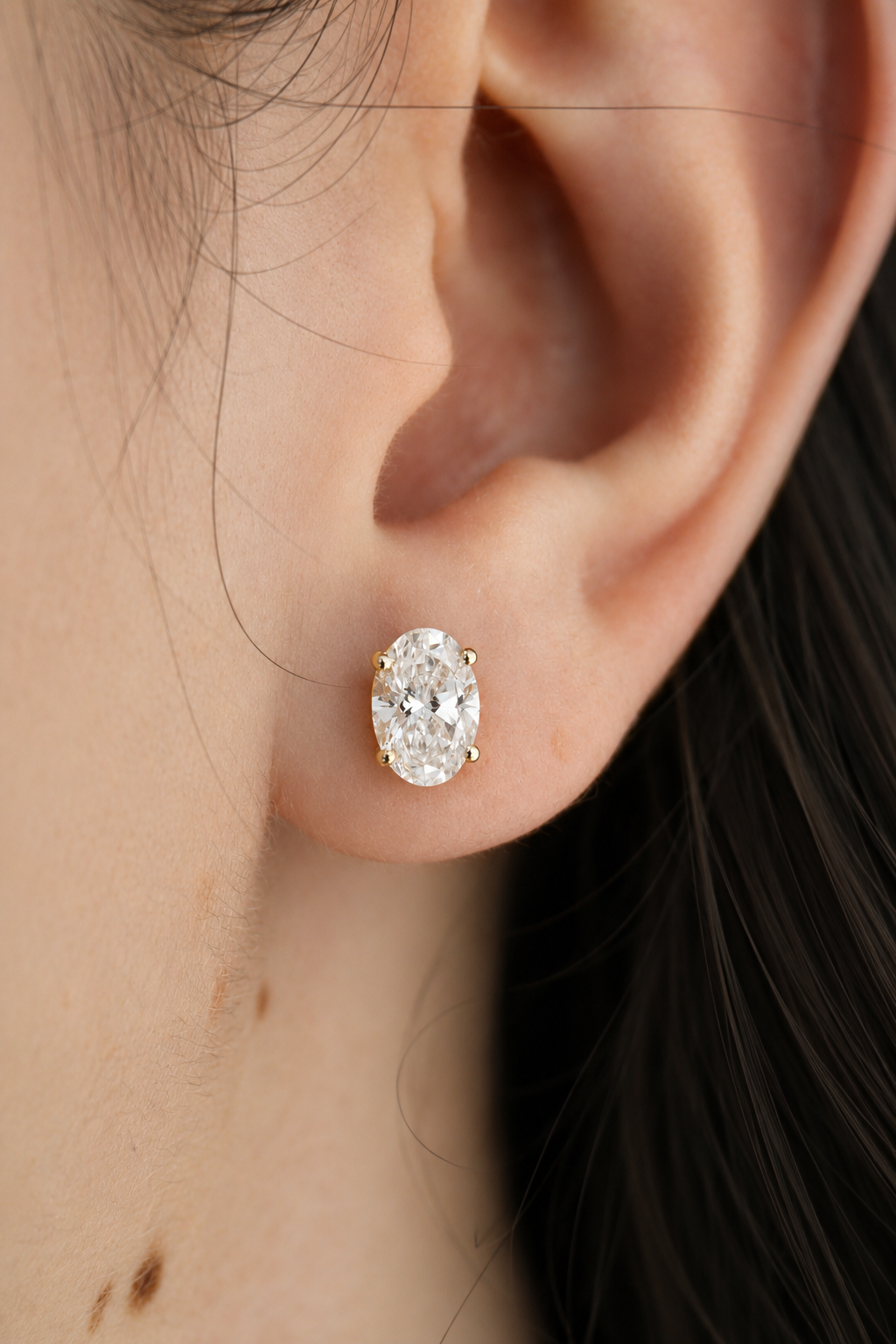 Aretes