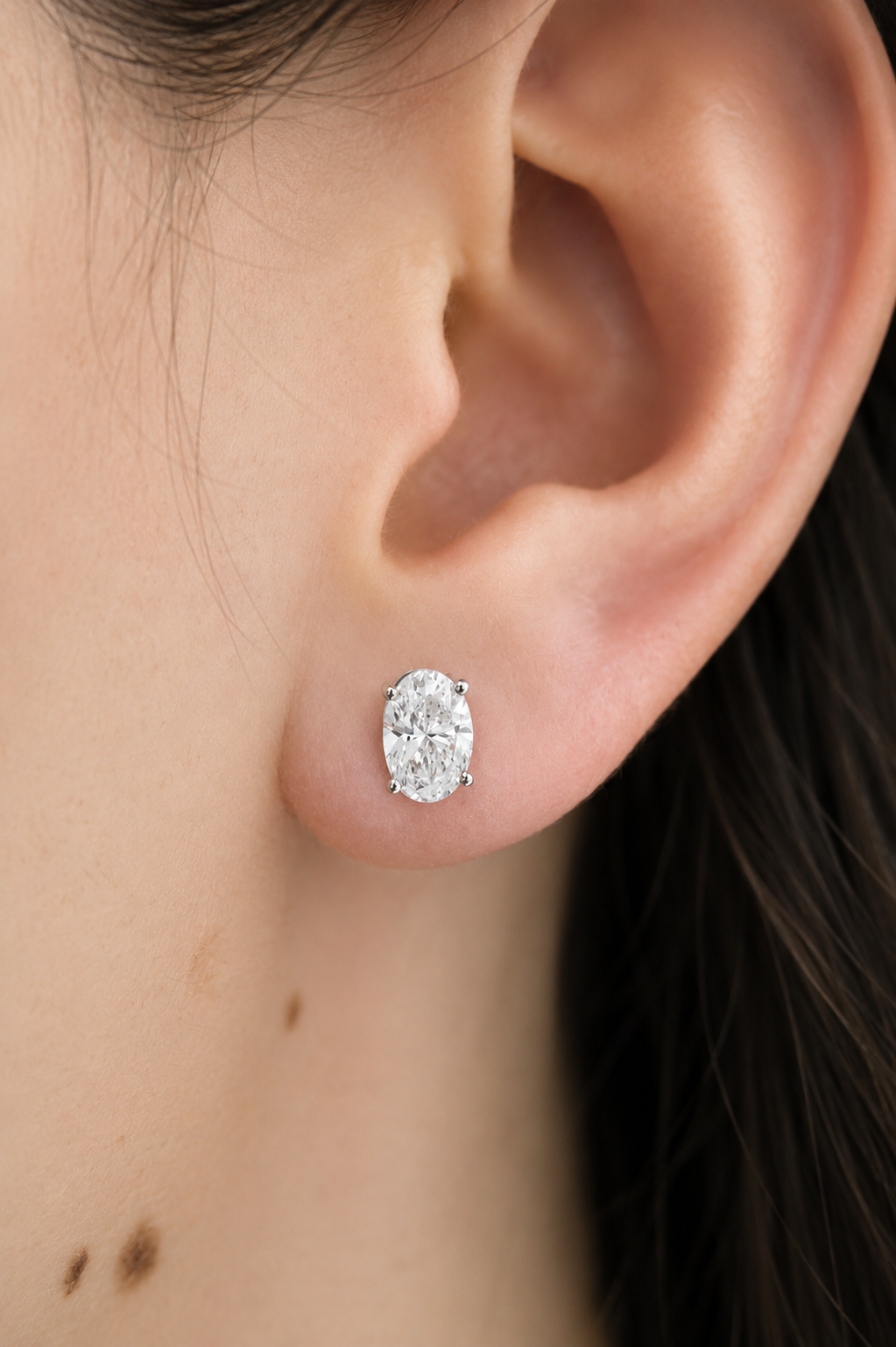 Aretes