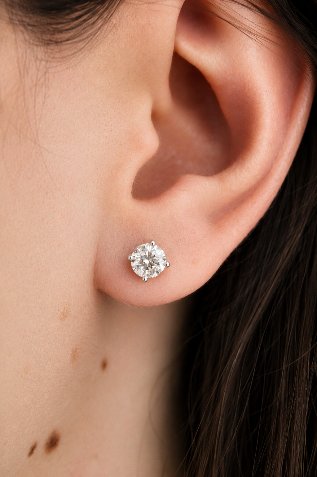 Aretes